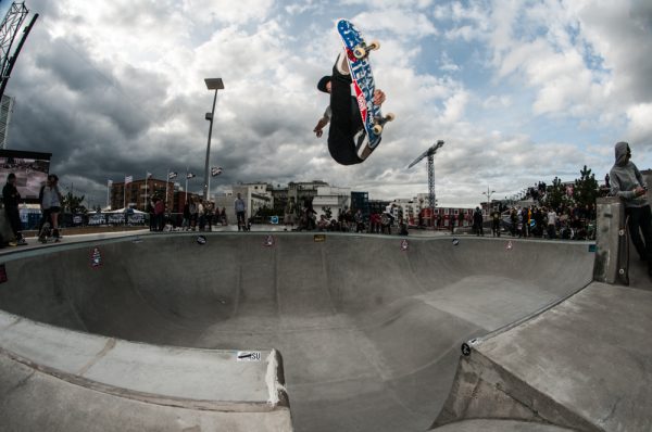 Bjørn Lillesøe. Nose bone transfer. Photo: Nicola Debernardi